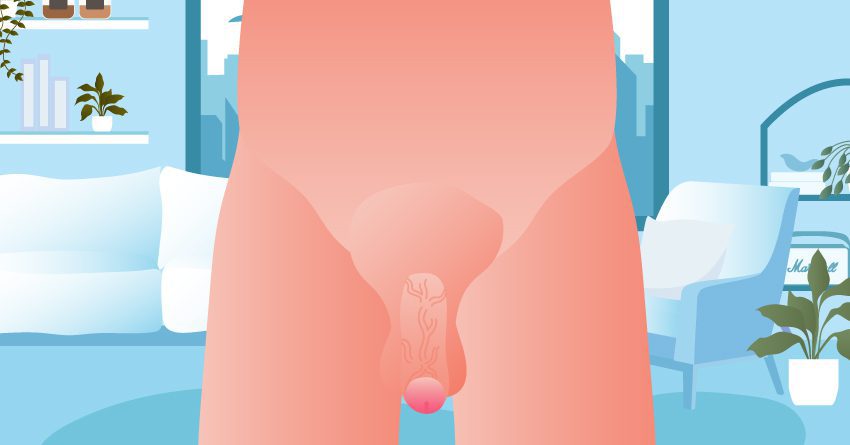 bệnh STIs là gì?